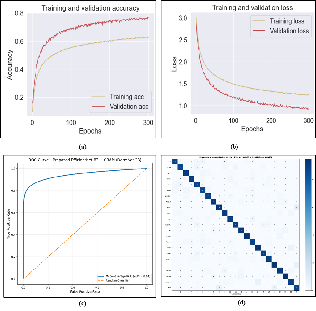 Fig. 4: The result of proposed EfficientNet-B3 + CBAM (a) Accuracy, (b) Loss (c) ROC Curve (d) Confusion Matrix