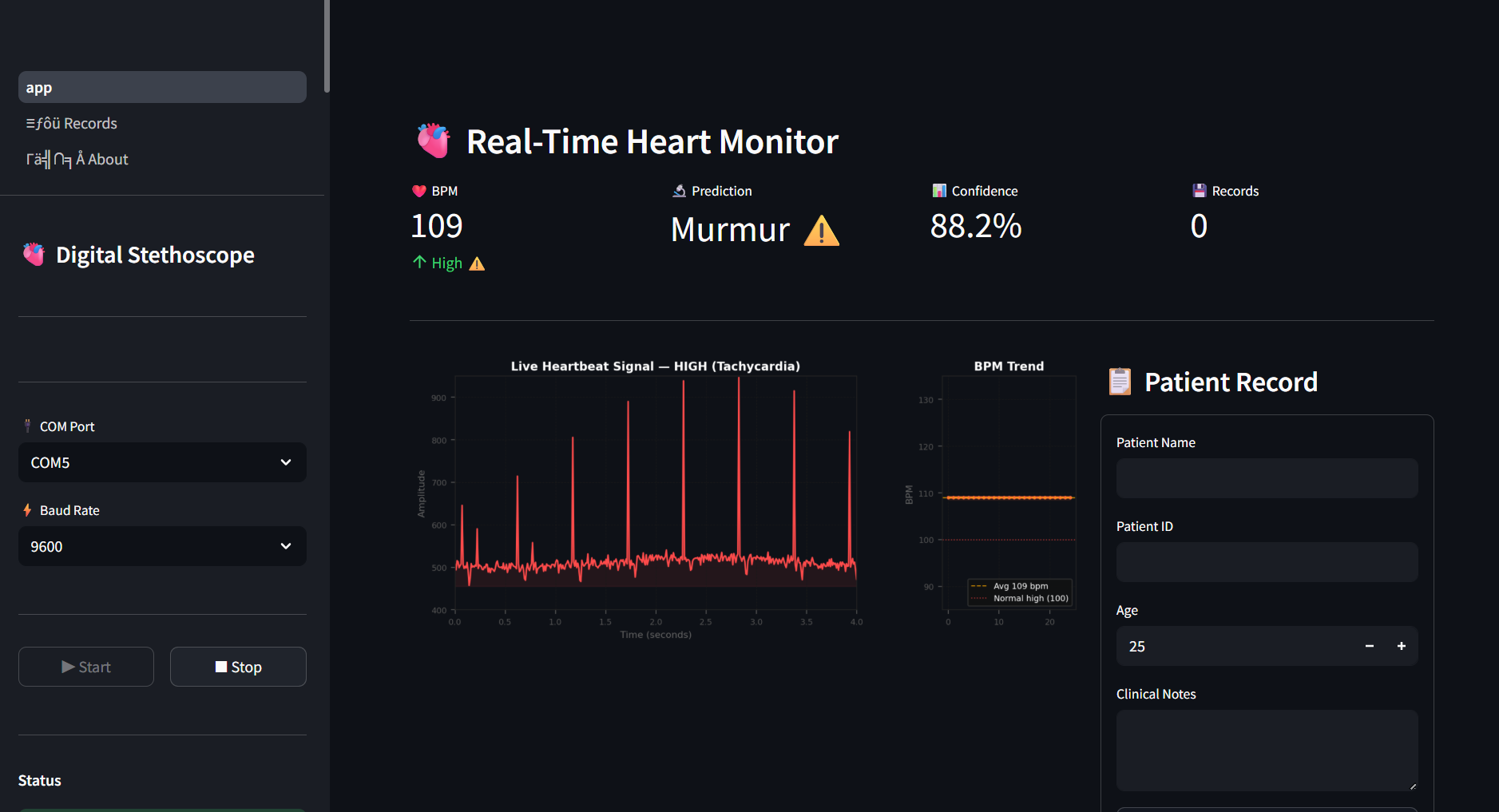 Fig. 5a: Streamlit dashboard showing abnormal heart sound classification with murmur prediction (Panel A).